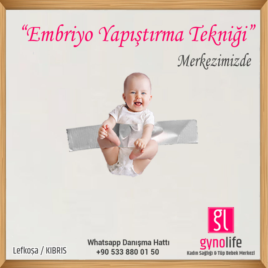 Embriyo Yapıştırma tekniği - tüp bebek tedavisi - kıbrıs tüp bebek - gyno life - tüp bebek merkezi -